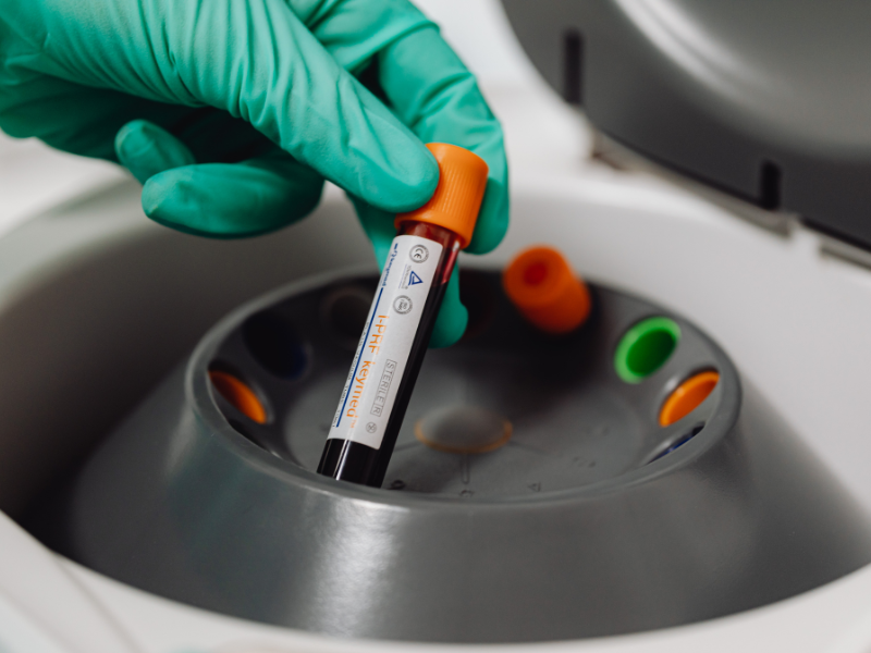 STD Test Bali, A Hassle-Free Sexual Health Solution